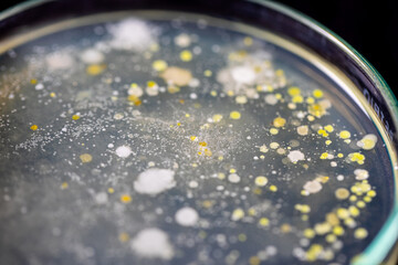Backgrounds of Characteristics and Different shaped Colony of Bacteria and Mold growing on agar plates from Soil samples for education in Microbiology laboratory.