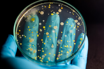 Backgrounds of Characteristics and Different shaped Colony of Bacteria and Mold growing on agar...