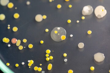 Backgrounds of Characteristics and Different shaped Colony of Bacteria and Mold growing on agar plates from Soil samples for education in Microbiology laboratory.