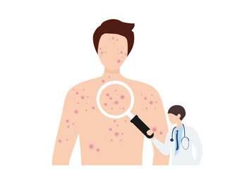 Man suffering from new virus Monkeypox infection vector illustration. Smallpox virus concept