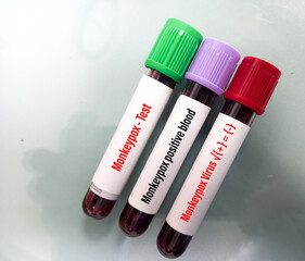 Blood sample tube for Monkeypox virus test. It is a double-stranded DNA, zoonotic virus and a species of the genus Orthopoxvirus in the family Poxviridae.