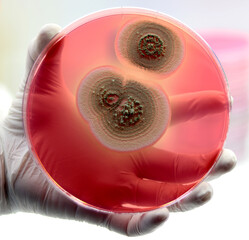 Isolated fungal colonies in the laboratory