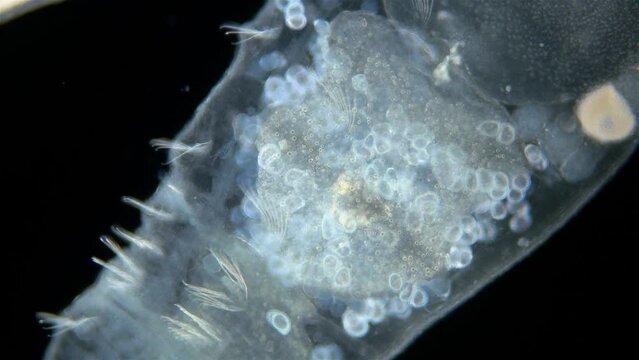 Worm Chaetogaster sp. under the microscope, Class Oligochaeta. Lives in fresh water. In the video, the intestines with the remnants of food