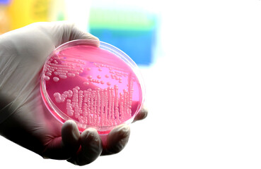 Hand of a researcher showing a close-up of a microbiological culture plate with yeasts isolated...
