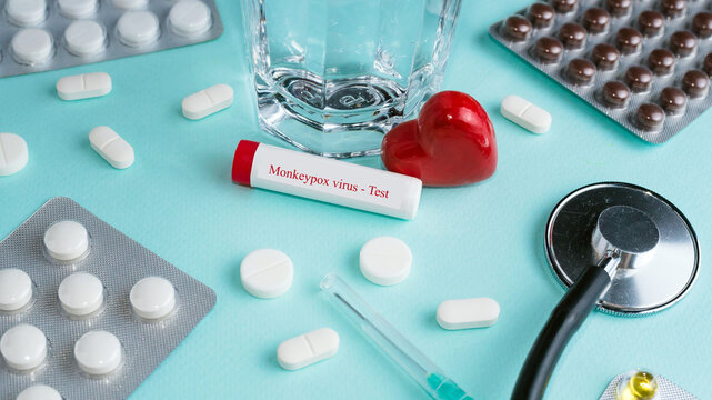 Blood sample tube for Monkeypox virus test. Blue background, thermometer, pill. Moneypox, is a double-stranded DNA, zoonotic virus and a species of the genus Orthopoxvirus in the family Poxviridae