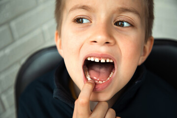 A boy of 6-7 years old shows the first teeth that grow after the loss of milk teeth. Close-up portrait