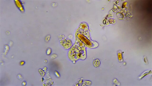 Micro organisms - Amoeba