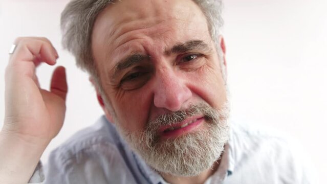 Closeup shot of a disgusted elder caucasian bearded man scratching his head, and looking at his hair. Dandruff concept. High quality 4k footage