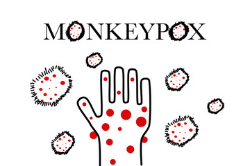 Monkeypox cell infection pandemic.symptom monkeypox cell with doctor in laboratory lab confirm.Monkeypox is a rare disease infection with virus.Sexual Health in uk.infection in Africa Europe.icon.