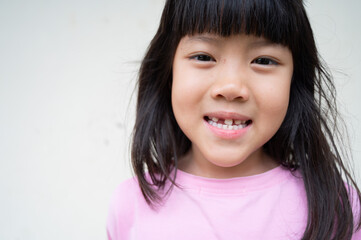 kid broken tooth, asian girl smiling