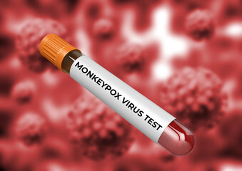 blood test to detect monkeypox viral infection transmitted from animals to humans