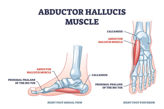 Abductor hallucis muscle with leg or foot skeleton outline diagram. Labeled educational medical scheme with proximal phalanx of big toe and calcaneus from medial and posterior view vector illustration