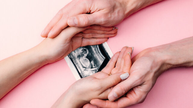 Ultrasound image pregnant baby photo. Woman hands holding ultrasound pregnancy picture on pink background. Pregnancy, medicine, pharmaceutics, health care and people concept.