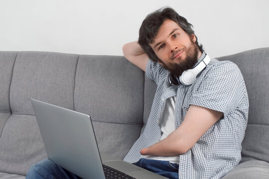 Handicapped disabled man with amputated two stump hands working on laptop at home looking at camera and smiling. Problem of adaptation to life people with disabilities. Independent Invalid person.