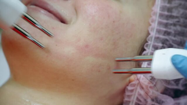Beautiful woman receiving facial microcurrent treatment at spa salon.
