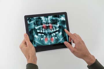 Discussing issues. Cropped shot of a professional dentist showing jaws and teeth x-rays to his patient using a digital tablet