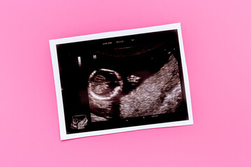 Pregnancy background with ultrasound picture of unborn baby