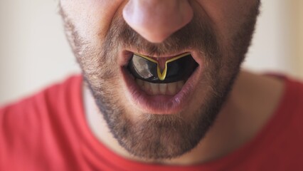 Angry and motivated male fighter shows off his mouthguard before fight