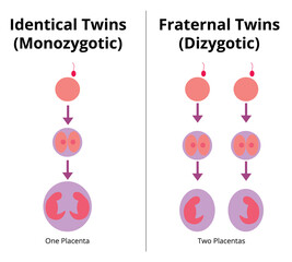 Difference between identical and fraternal twins. Monozygotic and dizygotic twins. Vector illustration.