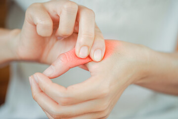 Finger pain woman due to various diseases related to bone Health care concept.