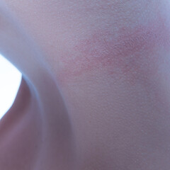 Female body texture. Close-up image of tender woman's body, slim belly. Health, skincare