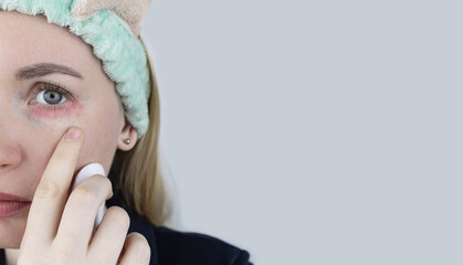 Allergy to cosmetics. The girl looks at the pimples around her eyes that appeared after using toxic...