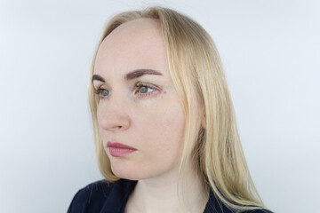 Naklejka premium Allergy to cosmetics. The girl looks at the pimples around her eyes that appeared after using toxic cosmetics. Red spots on woman skin