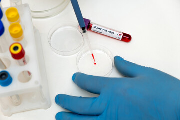 A medical worker works with a sample of blood infected with monkeypox in the laboratory.Epidemic of monkeypox in Europe and the USA.Selective focus,close-up.