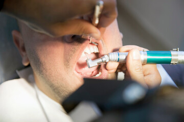 Dentist is Trying To Fix A Broken Teeth