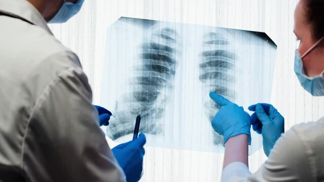 Healthcare and medicine. Doctors examining lungs x-ray close-up. Nurse and therapist looking at ribs roentgen, human chest, checkup. 