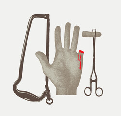 human hand with cut off finger on medical tweezers with blood and amputation saw - obrazy, fototapety, plakaty