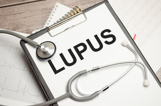 Notebook with text LUPUS with pen and stethoscope