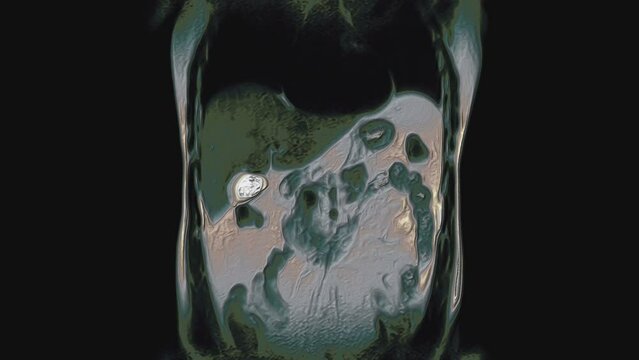 Bulk multicolored CT scan of the abdomen. Computed tomography of the gastrointestinal tract, liver and kidneys
