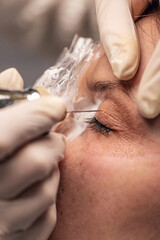 Woman eyelid wrinkles lifting