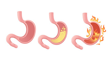 Human Stomach cartoon design human anatomy organ vector illustration on white background