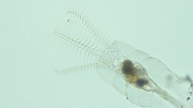 Rotifera Stephanoceros fimbriatus under the microscope, Family Collothecidae. Sessile rotifer, filters food with eyelash crown, unusual and beautiful