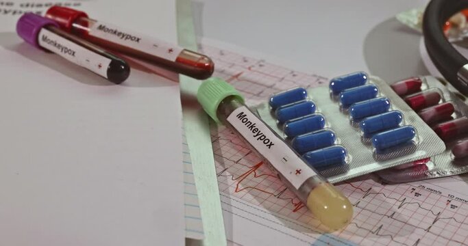Blood sample with Monkeypox virus check-up analysis in laboratory with health analysis screening report