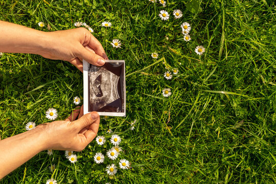 Ultrasound picture pregnant baby photo. Woman holding ultrasound pregnancy image on grass flower background. Concept of pregnancy, maternity, expectation for baby birth.