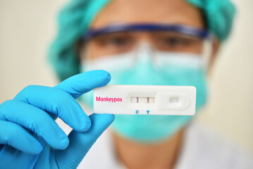Monkeypox positive, lab technician holding rapid diagnostic kit for Monkeypox virus, the result...