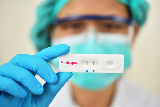 Monkeypox positive, lab technician holding rapid diagnostic kit for Monkeypox virus, the result showed positive