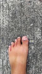 Abstract Defocused Injured and bleeding big toe on asphalt in Pangandaran, Indonesia