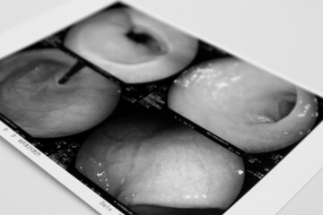 胃カメラの写真のクローズアップ
