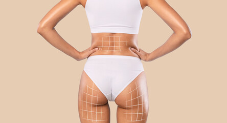 Cellulite Removal. Rear View Of Slim Woman With Fit Body