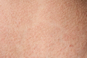 background of a pink skin texture. Healthy skin. Macro photo of skin cells.