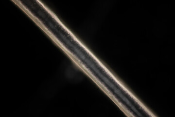 Scalp and hair follicles of human under the microscope in Lab.
