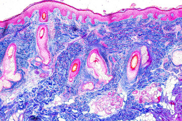 Scalp and hair follicles of human under the microscope in Lab.