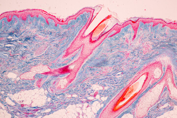 Scalp and hair follicles of human under the microscope in Lab.