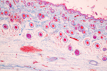 Scalp and hair follicles of human under the microscope in Lab.