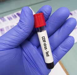 Blood sample for CCHF(Crimean Congo hemorrhagic fever) virus test, Nairobi sheep disease virus,...