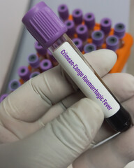 Blood sample for Crimean Congo hemorrhagic fever(CCHF) virus test, Nairobi sheep disease virus,...